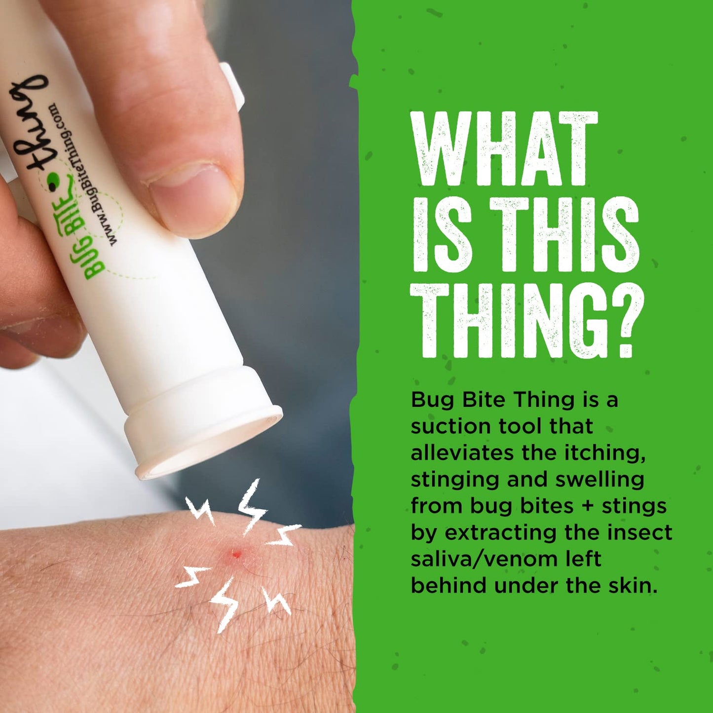 BUG BITE THING Suction Tool - Bug Bites and Bee/Wasp Stings, Natural Insect Bite Relief - 1-pack/Sea Glass