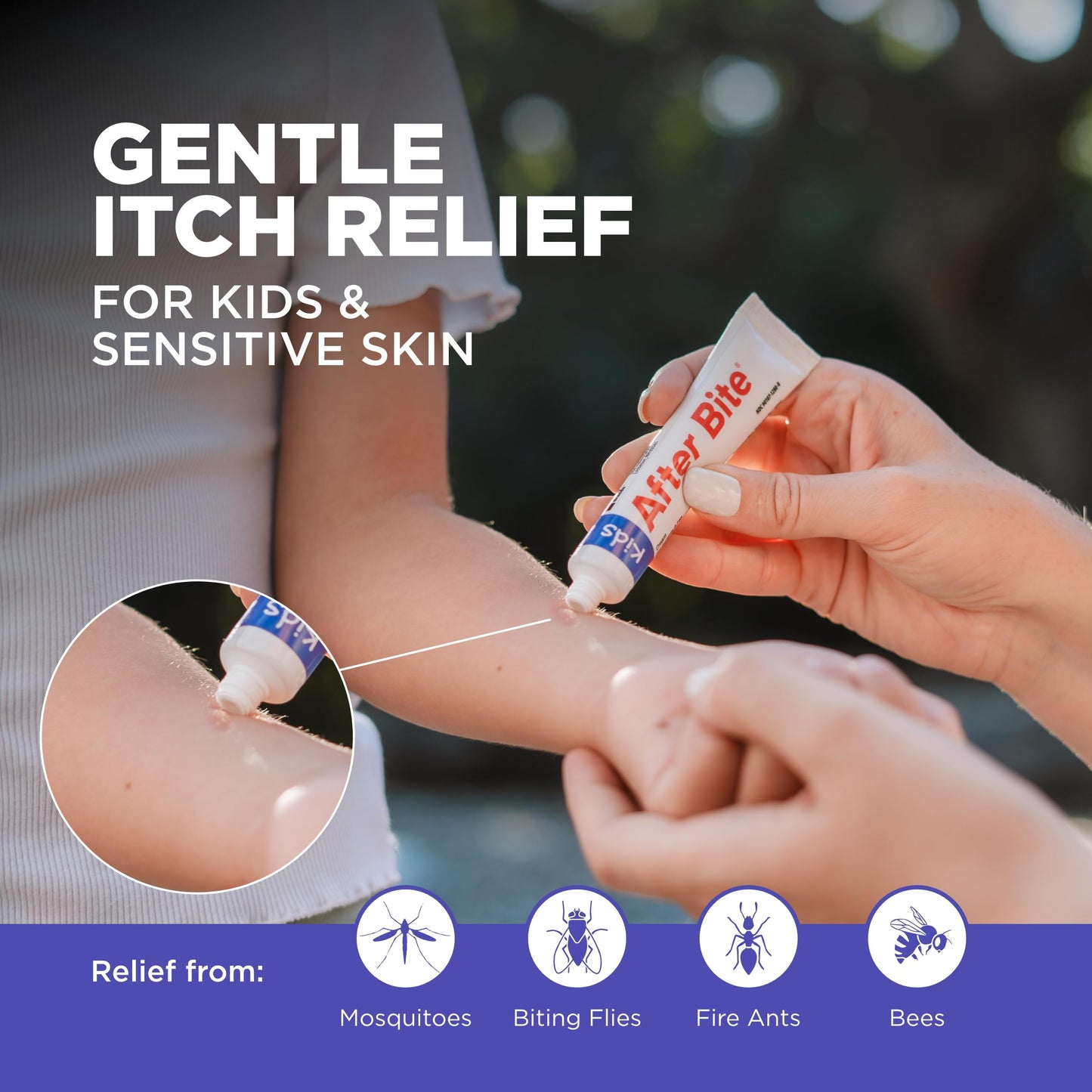 After Bite Kids - Bug Bite Itch Relief for Kids with Sodium Bicarbonate - Ideal for Mosquito Bites, Fire Ant Bites, Bees & More - Portable Cream Formula - 0.7 oz (4 Pack)
